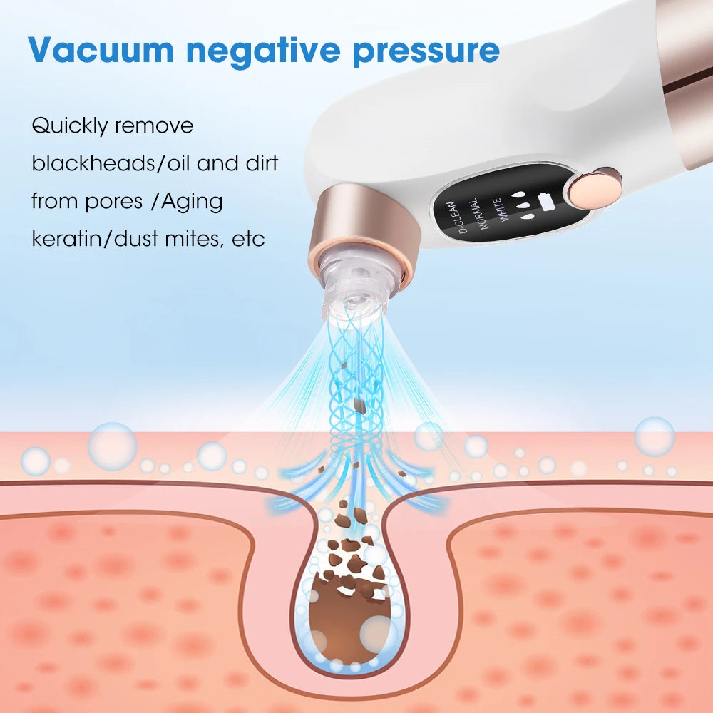 Electric Bubble Blackhead Remover / Ultrasonic Skin Scrubber Skin Care Tool Vacuum Suction Pore Cleanser Pimple Black Head Extractor Facial Lifting Cleaning Tools