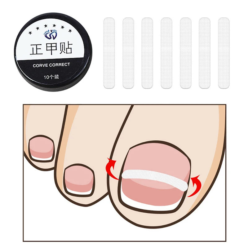 10pcs Ingrown Toe Nail Treatment Ingrown Toenail Correction Tool Elastic Patch Sticker Straightening Clip Brace Pedicure Tool